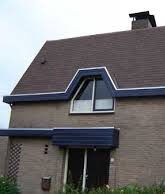 Shingles 4